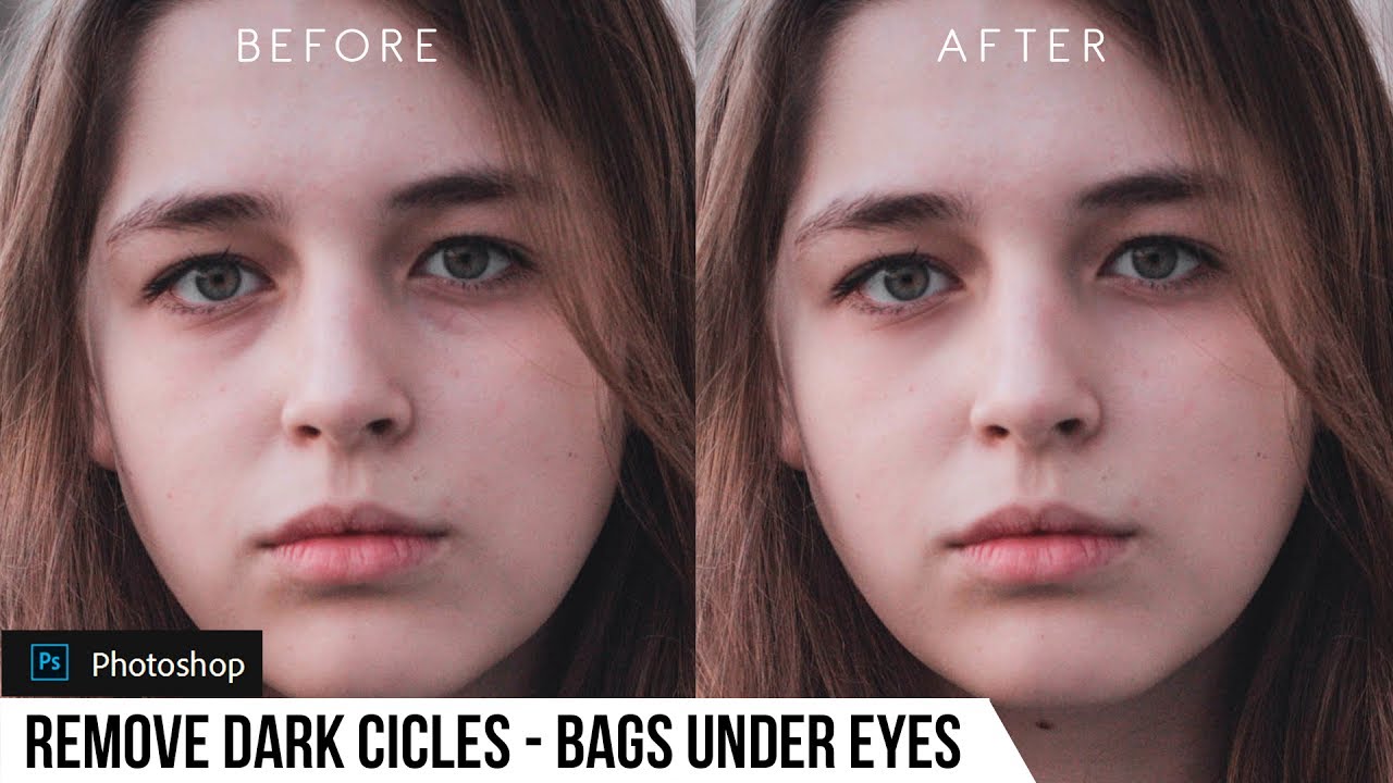 How to Remove Dark Circles and Bags Under Eyes in Photoshop