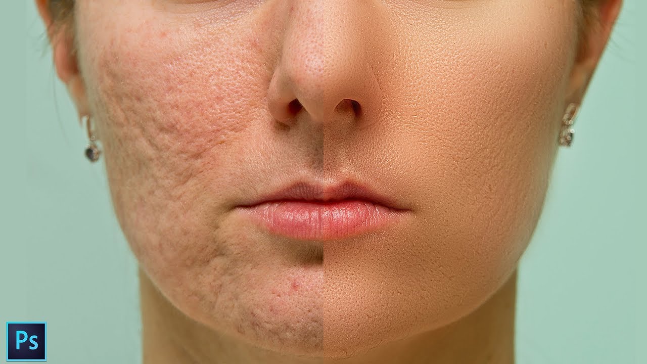 High-End Skin Softening Using Frequency Separation Technique in Photoshop